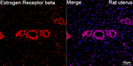Estrogen Receptor beta Antibody in Immunohistochemistry (Paraffin) (IHC (P))