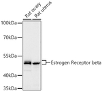 Estrogen Receptor beta Antibody in Western Blot (WB)