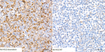 DFNA5 Recombinant Rabbit Monoclonal Antibody (8Y3R1)