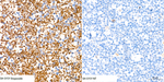 DFNA5 Antibody in Immunocytochemistry (ICC/IF)