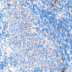 MRPL20 Antibody in Immunohistochemistry (Paraffin) (IHC (P))