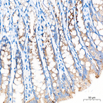 MRPL20 Antibody in Immunohistochemistry (Paraffin) (IHC (P))