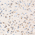 MRPL20 Antibody in Immunohistochemistry (Paraffin) (IHC (P))