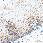 MRPL20 Antibody in Immunohistochemistry (Paraffin) (IHC (P))