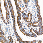 MRPL20 Recombinant Rabbit Monoclonal Antibody (2E7F9)