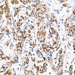 MRPL20 Antibody in Immunohistochemistry (Paraffin) (IHC (P))