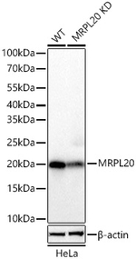 MRPL20 Antibody in Western Blot (WB)