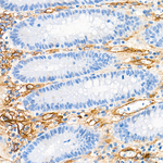 Neuropilin 1 Antibody in Immunohistochemistry (Paraffin) (IHC (P))