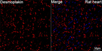Desmoplakin Recombinant Rabbit Monoclonal Antibody (3O5O3)