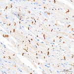 Desmoplakin Antibody in Immunohistochemistry (Paraffin) (IHC (P))