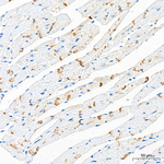 Desmoplakin Antibody in Immunohistochemistry (Paraffin) (IHC (P))