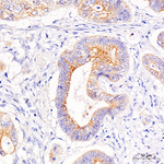 Desmoplakin Antibody in Immunohistochemistry (Paraffin) (IHC (P))