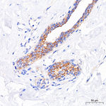 Desmoplakin Antibody in Immunohistochemistry (Paraffin) (IHC (P))
