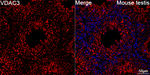 VDAC3 Antibody in Immunohistochemistry (Paraffin) (IHC (P))