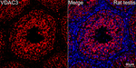 VDAC3 Antibody in Immunohistochemistry (Paraffin) (IHC (P))