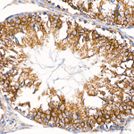 VDAC3 Antibody in Immunohistochemistry (Paraffin) (IHC (P))