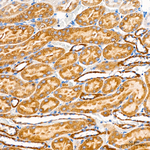 VDAC3 Antibody in Immunohistochemistry (Paraffin) (IHC (P))