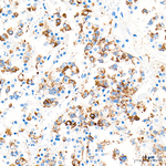 Prolactin Antibody in Immunohistochemistry (Paraffin) (IHC (P))