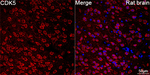 CDK5 Antibody in Immunohistochemistry (Paraffin) (IHC (P))