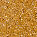 CDK5 Antibody in Immunohistochemistry (Paraffin) (IHC (P))