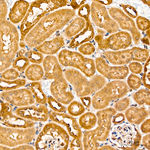CDK5 Antibody in Immunohistochemistry (Paraffin) (IHC (P))