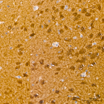 CDK5 Antibody in Immunohistochemistry (Paraffin) (IHC (P))