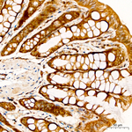 CDK5 Antibody in Immunohistochemistry (Paraffin) (IHC (P))