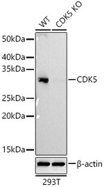 CDK5 Antibody in Western Blot (WB)