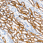 UQCRC1 Antibody in Immunohistochemistry (Paraffin) (IHC (P))