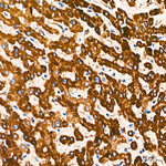 UQCRC1 Antibody in Immunohistochemistry (Paraffin) (IHC (P))