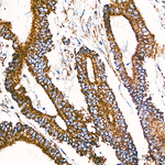 UQCRC1 Antibody in Immunohistochemistry (Paraffin) (IHC (P))
