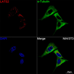 LATS2 Recombinant Rabbit Monoclonal Antibody (3K7B3)