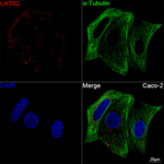 LATS2 Antibody in Immunocytochemistry (ICC/IF)