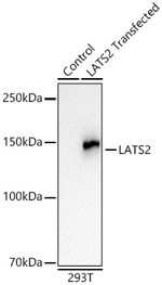 LATS2 Antibody in Western Blot (WB)