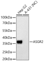 ASGR2 Antibody in Western Blot (WB)
