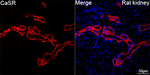 Calcium Sensing Receptor Antibody in Immunohistochemistry (Paraffin) (IHC (P))