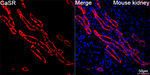 Calcium Sensing Receptor Antibody in Immunohistochemistry (Paraffin) (IHC (P))
