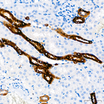Calcium Sensing Receptor Antibody in Immunohistochemistry (Paraffin) (IHC (P))