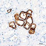 Calcium Sensing Receptor Antibody in Immunohistochemistry (Paraffin) (IHC (P))