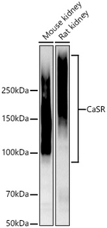 Calcium Sensing Receptor Antibody in Western Blot (WB)