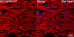 MYH6/MYH7 Antibody in Immunohistochemistry (Paraffin) (IHC (P))