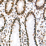 HDAC1 Antibody in Immunohistochemistry (Paraffin) (IHC (P))