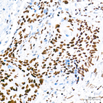 HDAC1 Antibody in Immunohistochemistry (Paraffin) (IHC (P))
