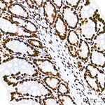 HDAC1 Antibody in Immunohistochemistry (Paraffin) (IHC (P))