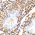HDAC1 Antibody in Immunohistochemistry (Paraffin) (IHC (P))