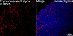 TOP2A Antibody in Immunohistochemistry (Paraffin) (IHC (P))