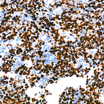 TOP2A Antibody in Immunohistochemistry (Paraffin) (IHC (P))