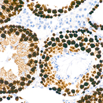 TOP2A Antibody in Immunohistochemistry (Paraffin) (IHC (P))