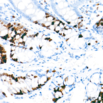 TOP2A Antibody in Immunohistochemistry (Paraffin) (IHC (P))