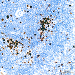 TOP2A Antibody in Immunohistochemistry (Paraffin) (IHC (P))